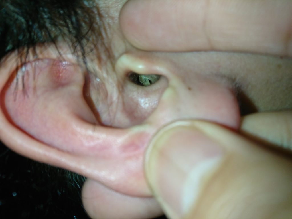 耳垢画像あり 人に耳の中を見てもらうのもありです 名古屋のヘッドマッサージ イヤーエステ専門店